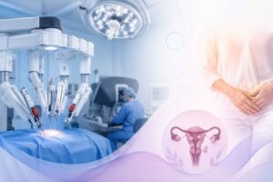 Robotic Myomectomy in South Delhi