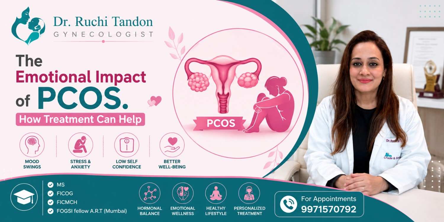 PCOS doctor in South Delhi