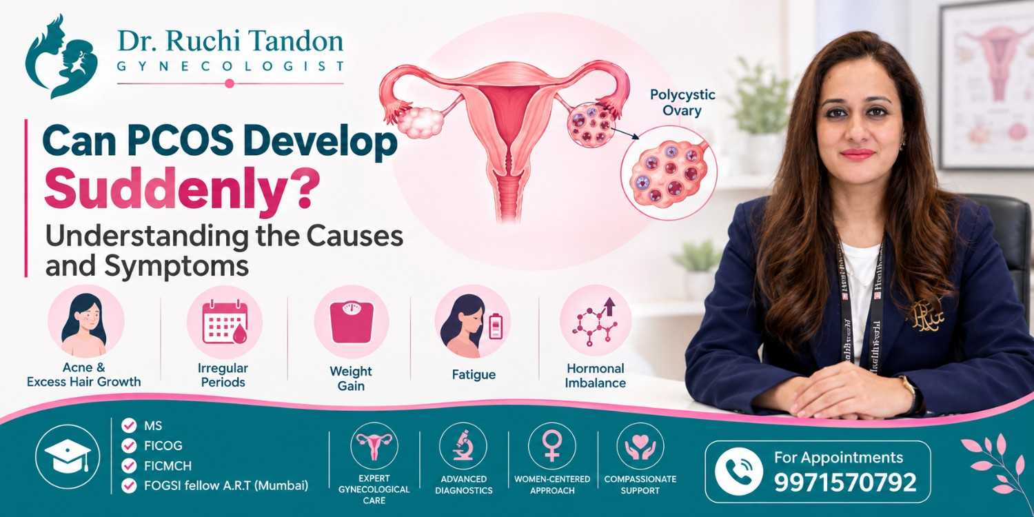 best PCOS doctor in South Delhi