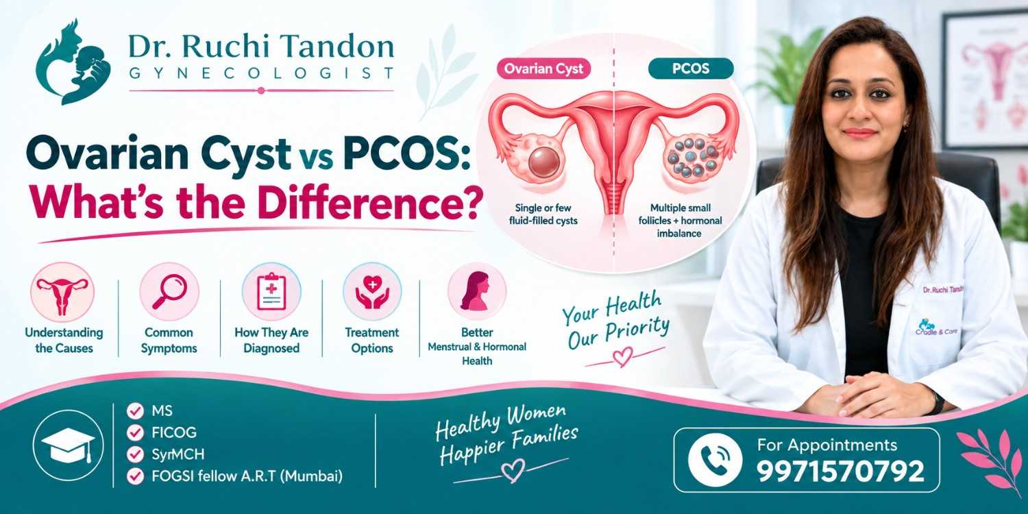 best ovarian cyst doctor in South Delhi